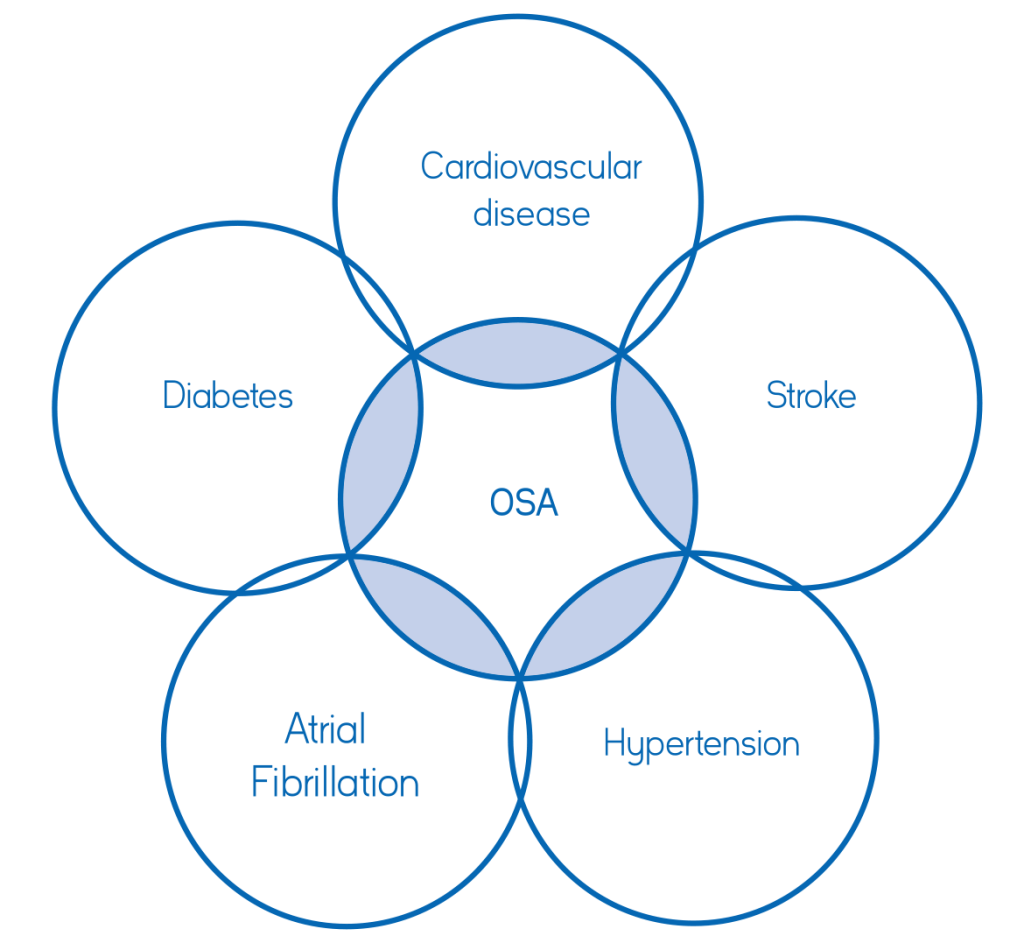 OSA linked with cardiovascular disease, stroke, hypertension, atrial fibrillation and diabetes